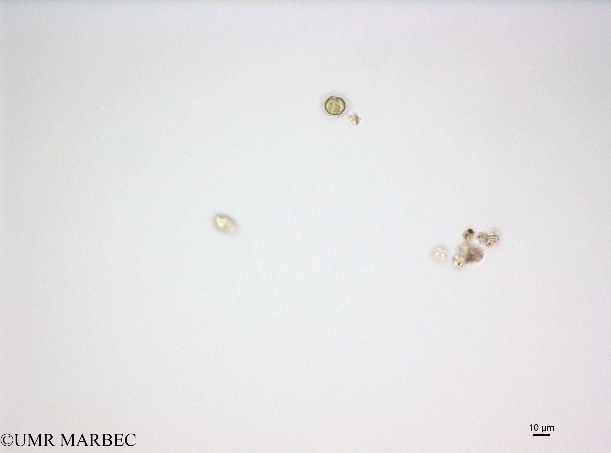 phyto/French_Polynesia/Moorea/PHYTOCONT June 2015/Scrippsiella spp (cf S. trochoidea-150730_001_ovl).TIF(copy).jpg